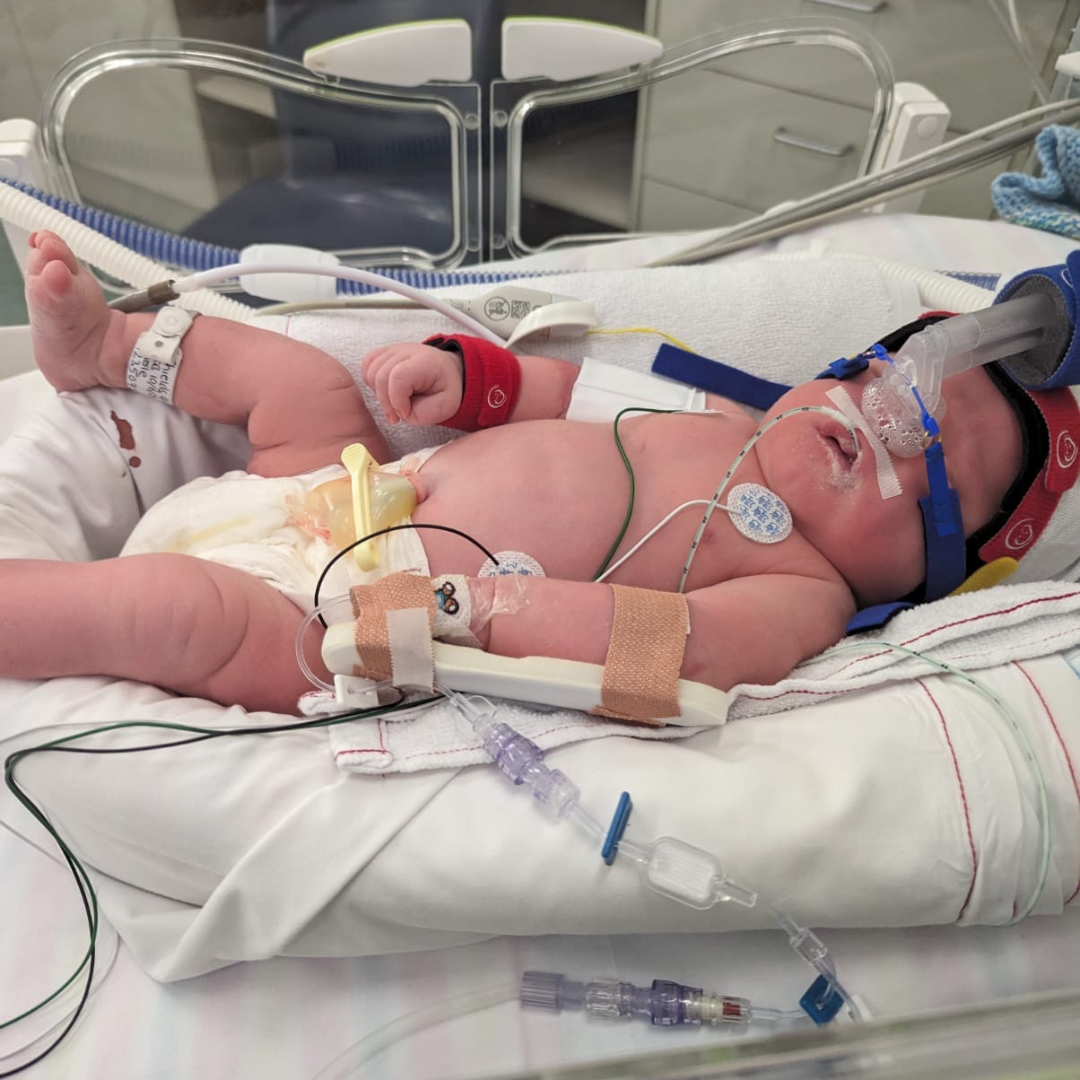 Hugo - Miracle Babies